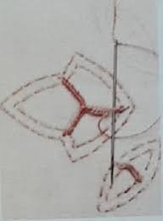 Bunjevacki bili sling 52